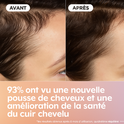 Brosse capillaire anti-chute et stimulante - Shape-Hair™